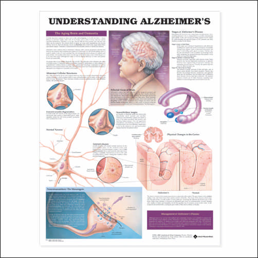 UNDERSTANDING ALZHEIMER'S UNMOUNTED CHART - Click Image to Close