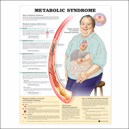 METABOLIC SYNDROME ANATOMICAL CHART - LIGHT LAMINATION - Click Image to Close