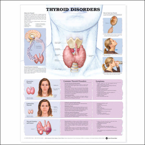 THYROID DISORDERS UNMOUNTED CHART - Click Image to Close