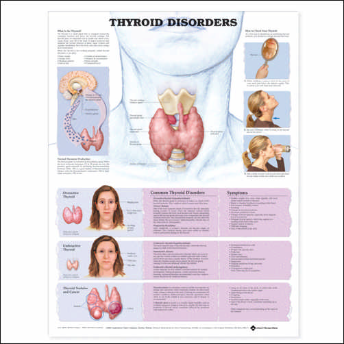 Sexually Transmitted Infections Anatomical Chart