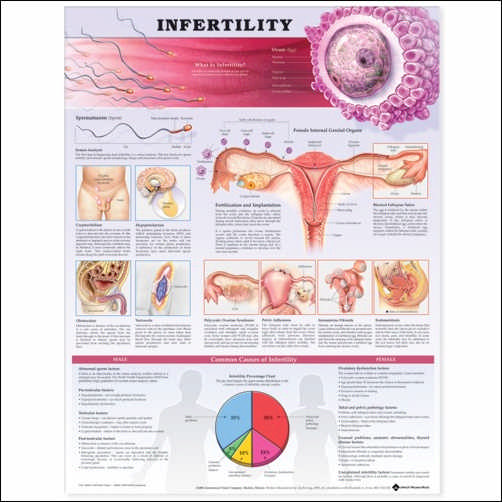 INFERTILITY PAPER CHART - Click Image to Close
