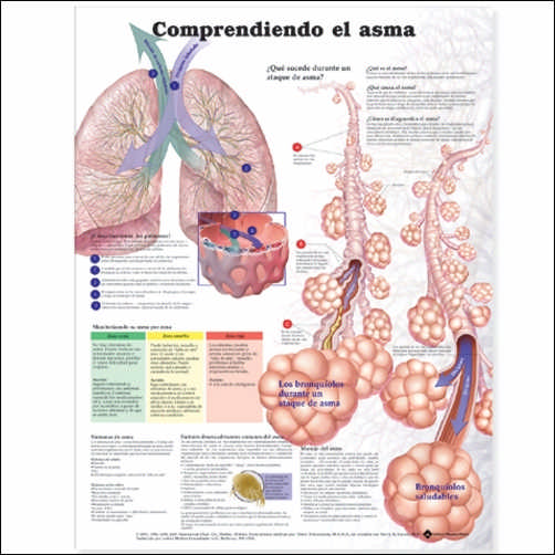 UNDERSTANDING ASTHMA IN SPANISH LAMINATED CHART - Click Image to Close