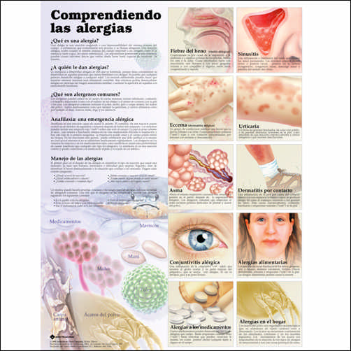 UNDERSTANDING ALLERGIES IN SPANISH CHART - LAMINATED - Click Image to Close