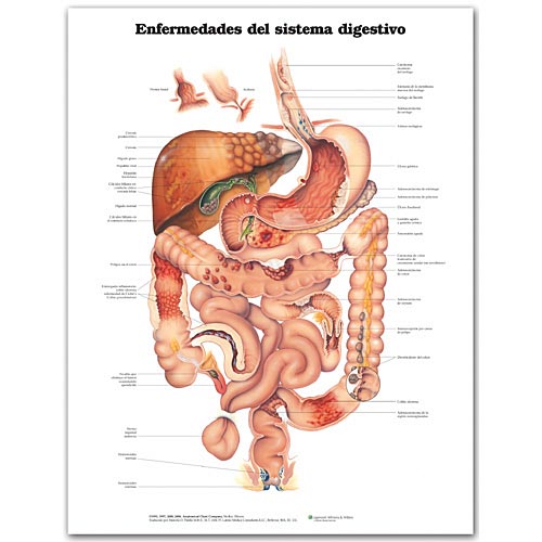 DISEASES OF THE DIGESTIVE SYSTEM IN SPANISH LAMINATED CHART - Click Image to Close