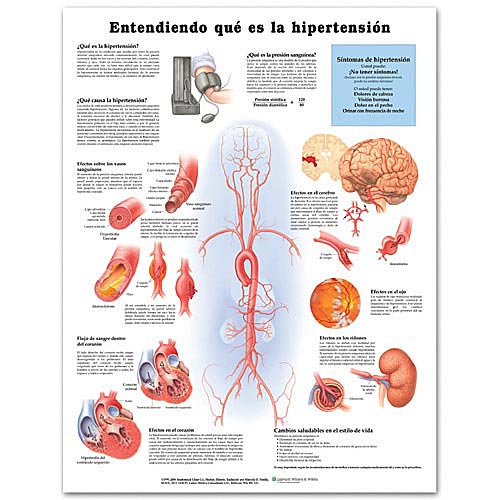 UNDERSTANDING HYPERTENSION IN SPANISH LAMINATED CHART - Click Image to Close