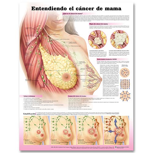 UNDERSTANDING BREAST CANCER IN SPANISH PAPER CHART - Click Image to Close