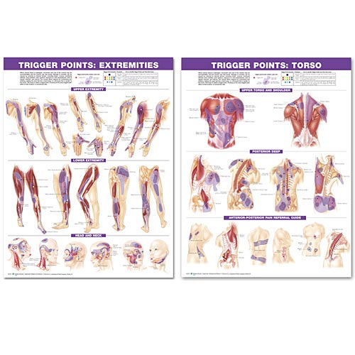 TRIGGER POINT CHART SET: TORSO & EXTREMITIES 2ND ED LAMINATED - Click Image to Close