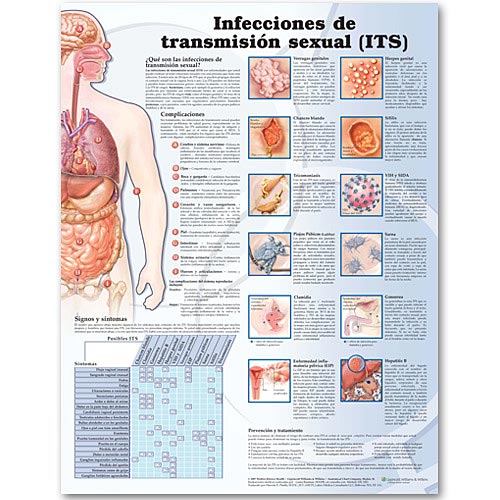 SEXUALLY TRANSMITTED INFECTIONS IN SPANISH LAMINATED CHART - Click Image to Close