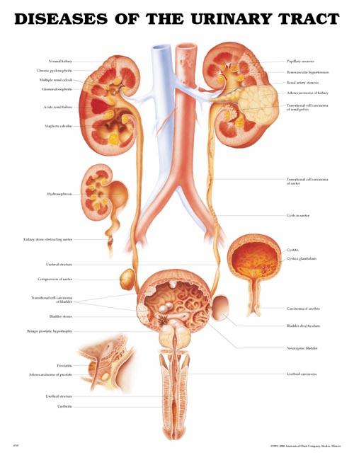 DISEASES OF THE URINARY TRACT UNMOUNTED CHART - Click Image to Close