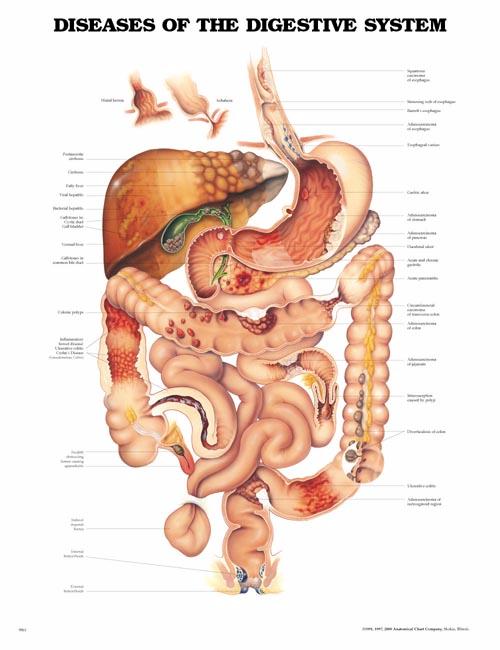 DISEASES OF THE DIGESTIVE SYSTEM UNMOUNTED CHART - Click Image to Close