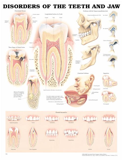 DISORDERS OF THE TEETH AND JAW FLEXIBLE LAMINATION - Click Image to Close