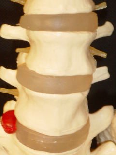BUDGET VERTEBRAL COLUMN WITH STAND - Click Image to Close
