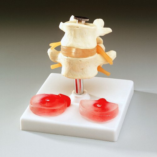 BUDGET LUMBAR VERTEBRAE WITH INTERCHANGEABLE DISCS - Click Image to Close