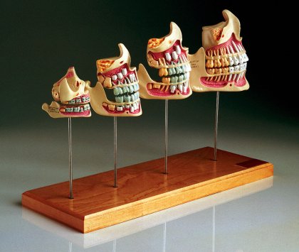 TEETH AND JAW DEVELOPMENT SET - Click Image to Close