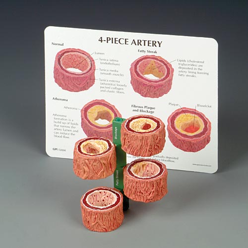 Artery Model 4 piece set - Click Image to Close