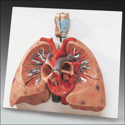 LUNGS WITH HEART MODEL - Click Image to Close