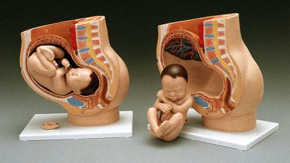 DELUXE PREGNANCY PELVIS MODEL - Click Image to Close
