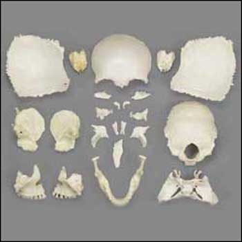 DISARTICULATED FEMALE SKULL - Click Image to Close