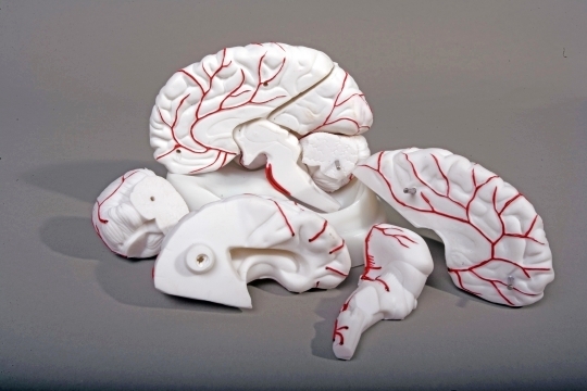 Brain Model with Arteries 8 parts - Click Image to Close